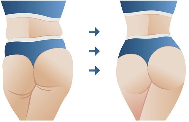 Your FQA Guide to Lymphatic Massages after plastic surgery - THE BEAUTY ANATOMY