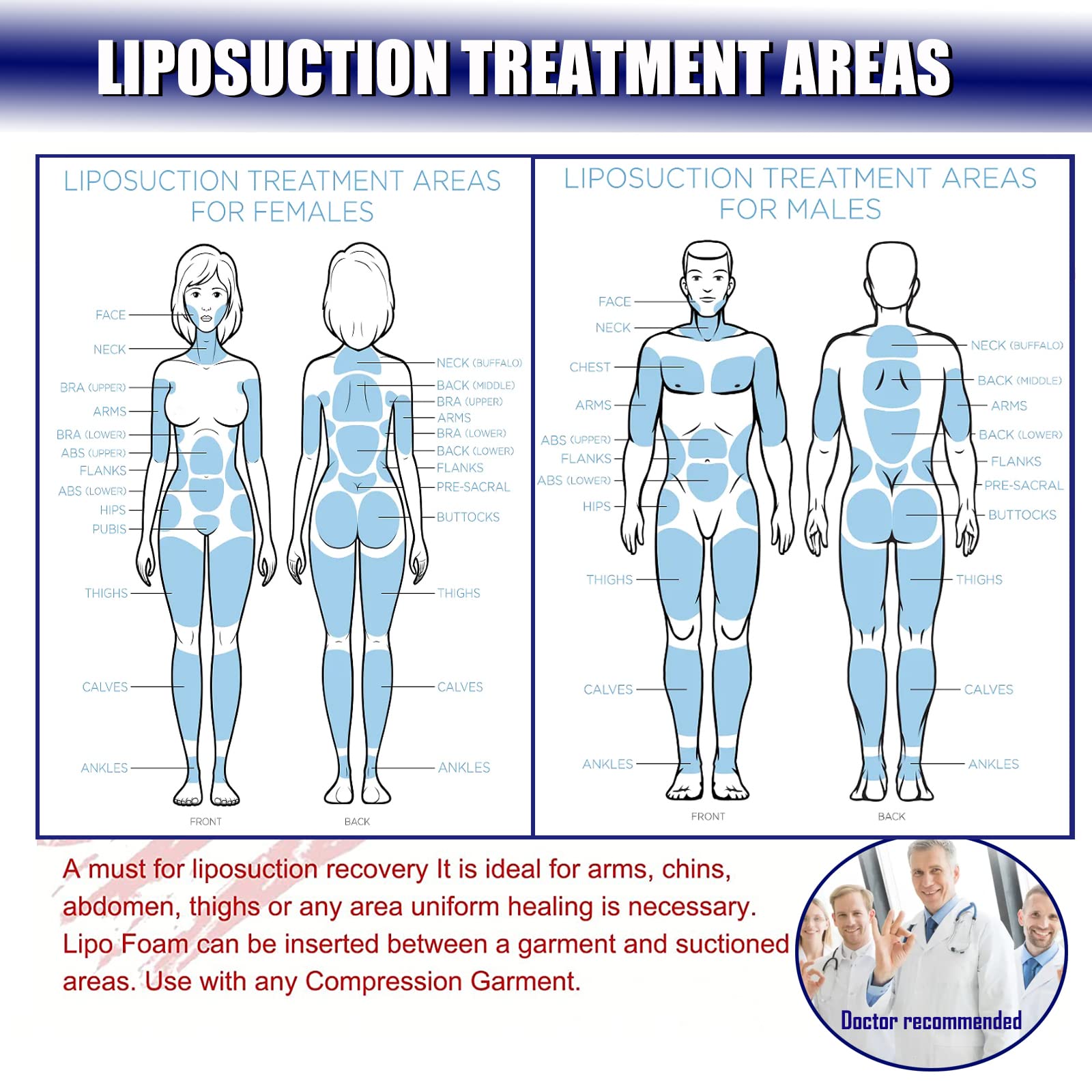 3 Pack Lipo Foam Ab Board Post Surgery Liposuction Abdominal Compression Board BBL Lumbar Molder Backboard for Liposuction - THE BEAUTY ANATOMY