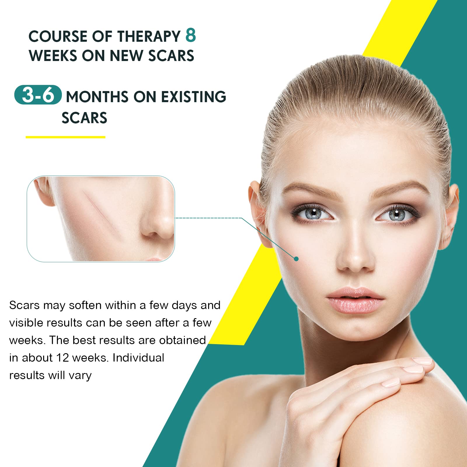 Silicone Scar Sheets - THE BEAUTY ANATOMY