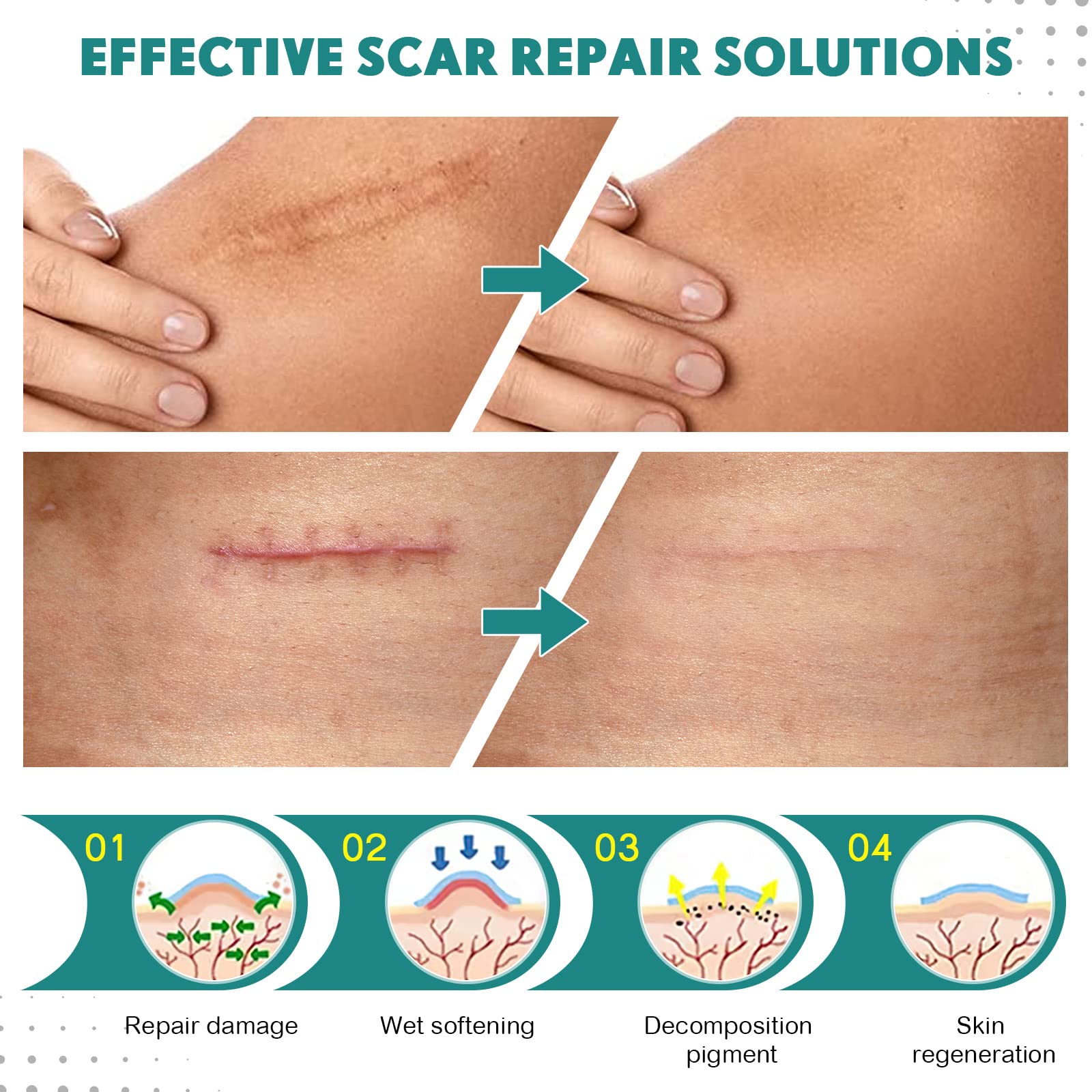 Silicone Scar Sheets - THE BEAUTY ANATOMY